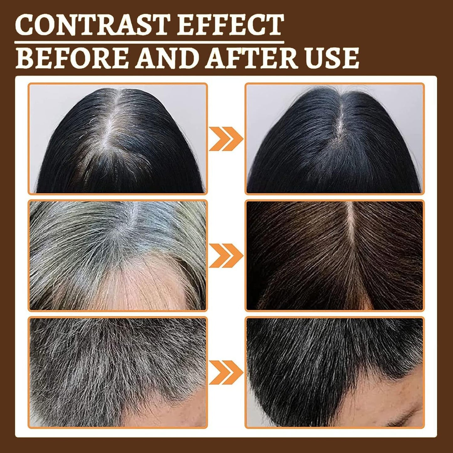 Anti-Greying Hair Serum - Promotes Hair Growth & Density, Damaged Hair Care
