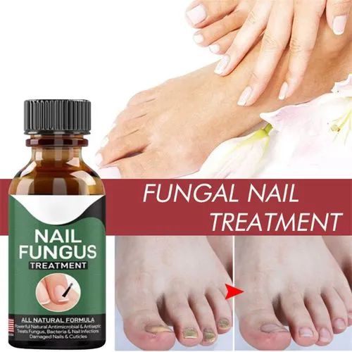 Foot Nail Fungus Removal Gel