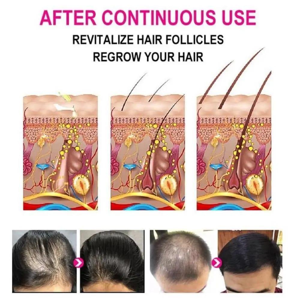 Anti-Greying Hair Serum - Promotes Hair Growth & Density, Damaged Hair Care